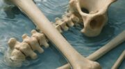 Кости и вода: почему важен баланс и как я однажды перестал хрустеть