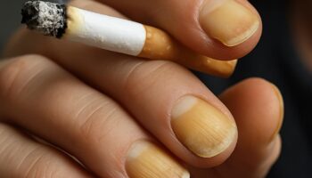 Ногти и курение: почему пластины желтеют и слоятся